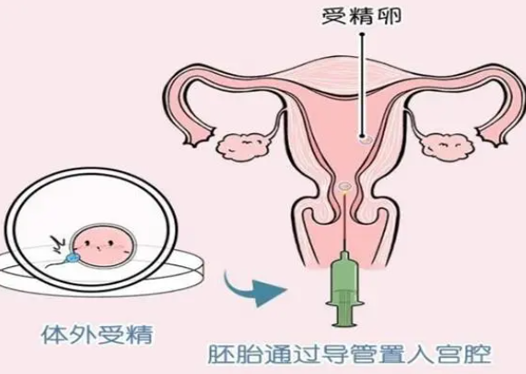 人工授精一次费用不低