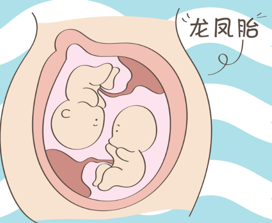 龙凤胎性别各异