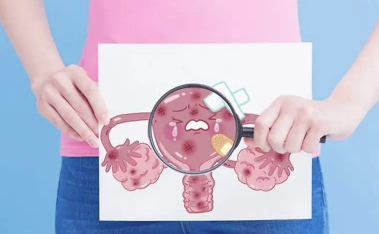 子宫腺肌症子宫增大1.png