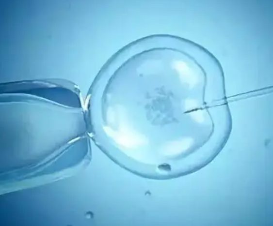 试管婴儿技术能实现生育
