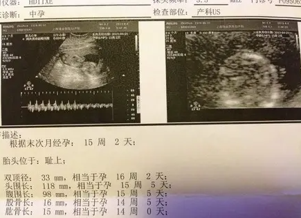 胎心率173次正常吗1.png