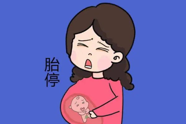 怀孕50天流产算生化妊娠吗