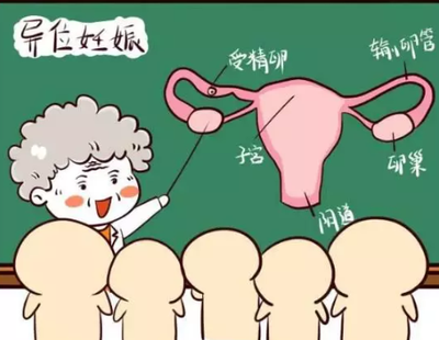 输卵管切除术后会不会宫外孕