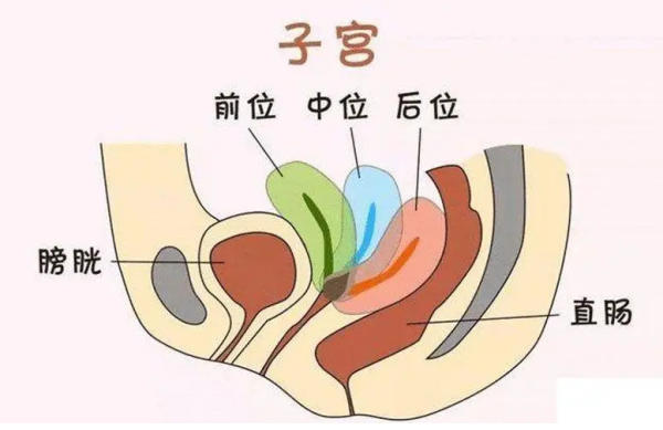 子宫前位和后位区分男女