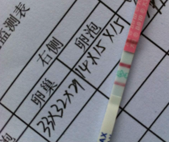 做排卵检测能提高怀孕几率