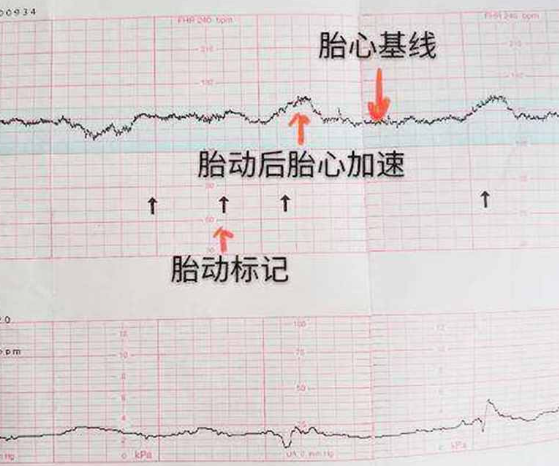 胎心看性别没有科学依据