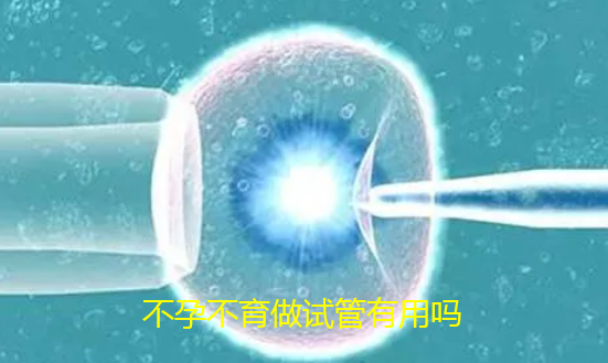 不孕不育做试管有用吗.png