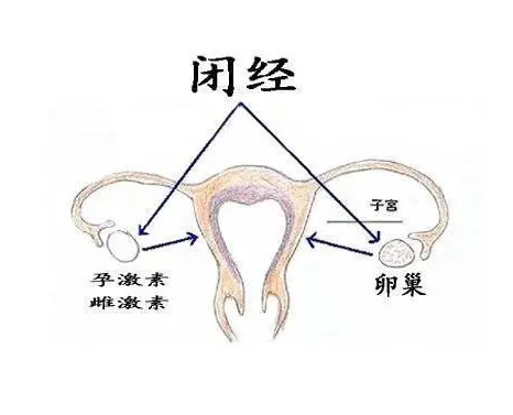 闭经后子宫正常还可以做试管婴儿吗？