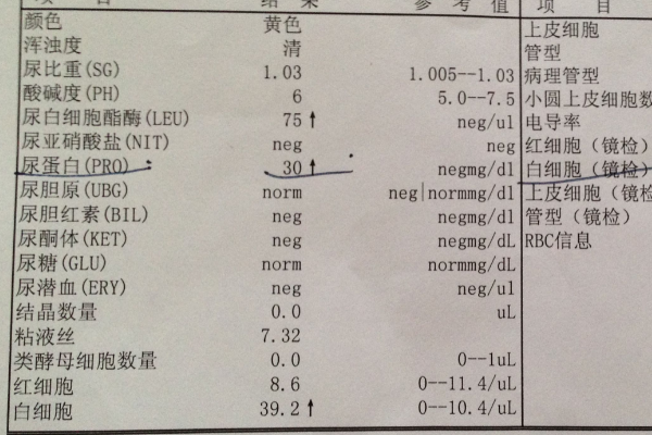 尿检呈阴性可做三代试管