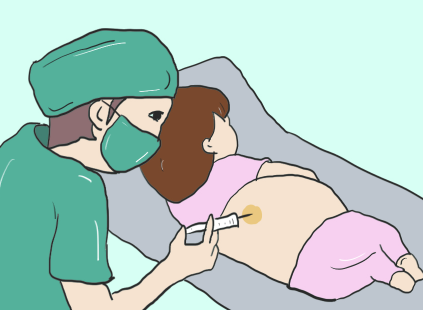 无痛分娩针有效时间
