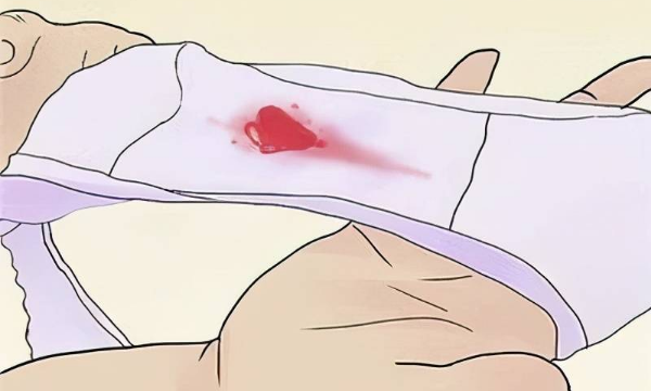 降调出血的三种情况